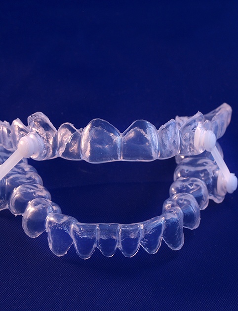 a sleep apnea oral appliance against a blue background